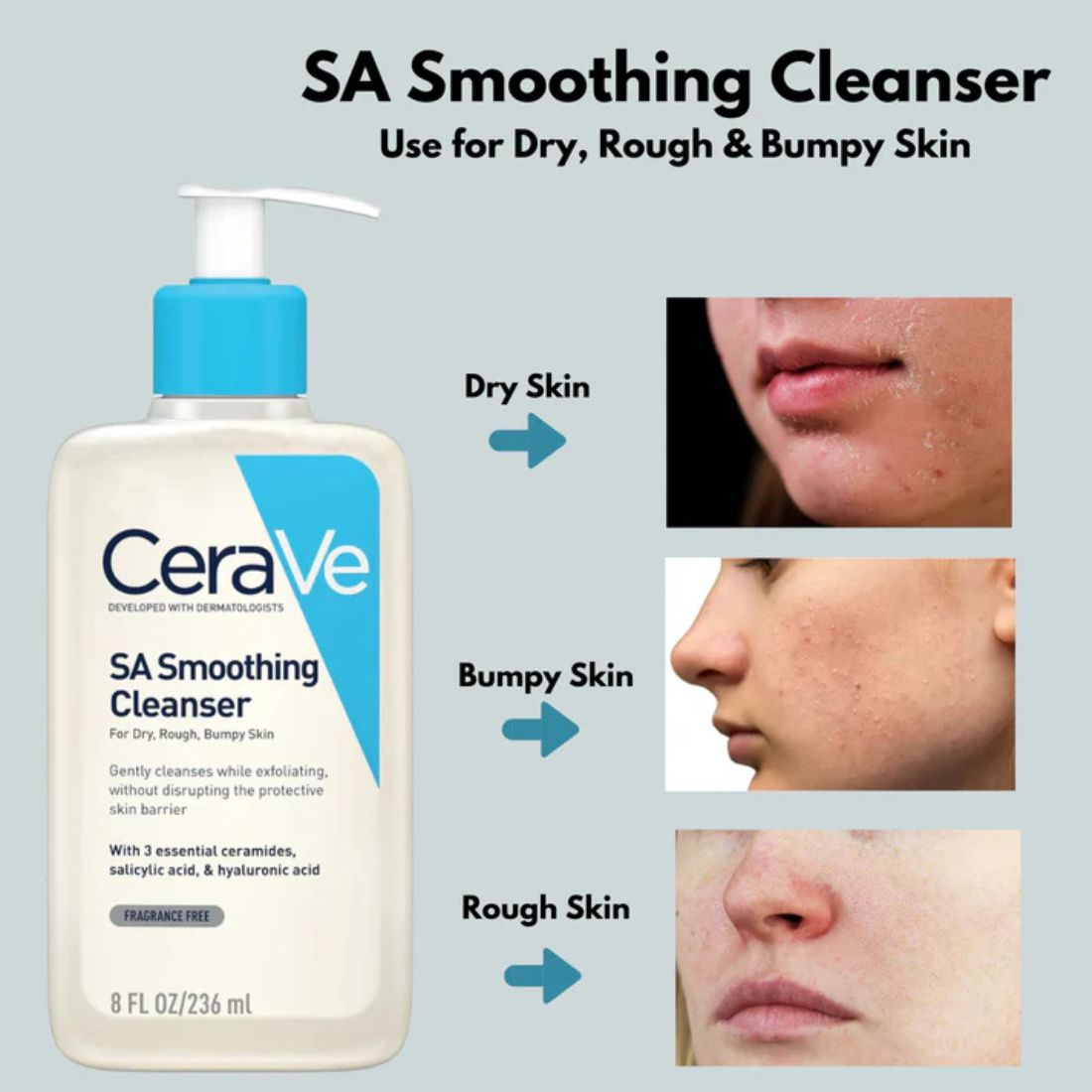 CeraVe SA Smoothing Cleanser for Dry, Rough and Bumpy Skin