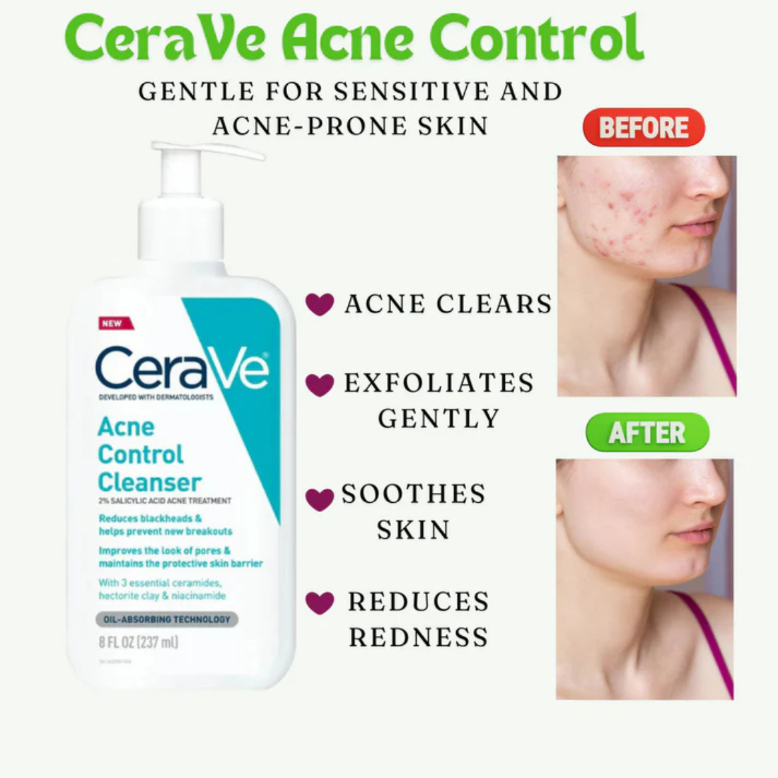 CeraVe Acne Control Cleanser 237ML